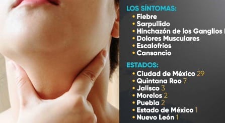 México en alerta por viruela del mono